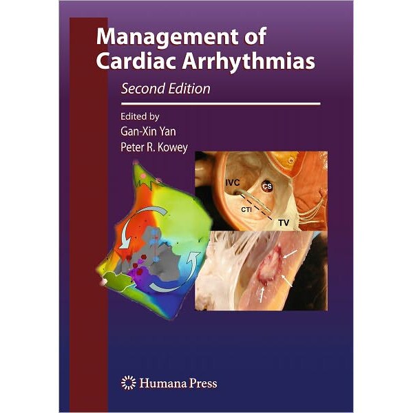 Management of Cardiac Arrhythmias de Gan-Xin Yan