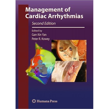 Management of Cardiac Arrhythmias de Gan-Xin Yan Management of Cardiac Arrhythmias de Gan-Xin Yan
