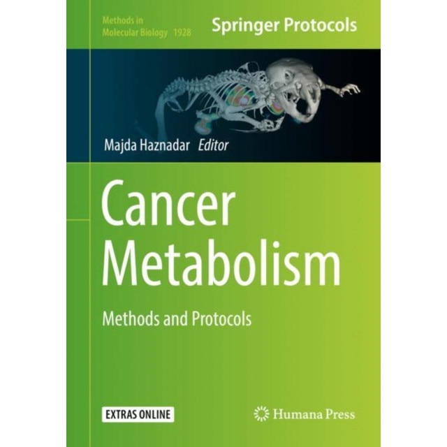 Cancer Metabolism de Majda Haznadar