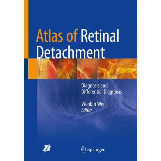 Atlas of Retinal Detachment de Wenbin Wei