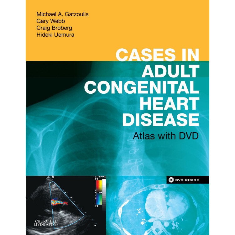 Cases in Adult Congenital Heart Disease - Expert Consult: Online and Print de Michael A. Gatzoulis