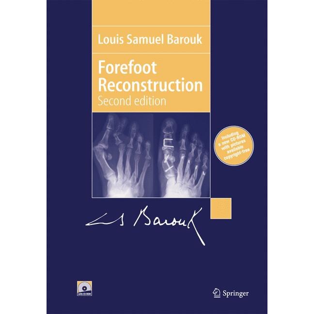 Forefoot Reconstruction de Louis-Samuel Barouk