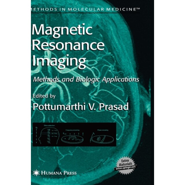 Magnetic Resonance Imaging de Pottumarthi V. Prasad