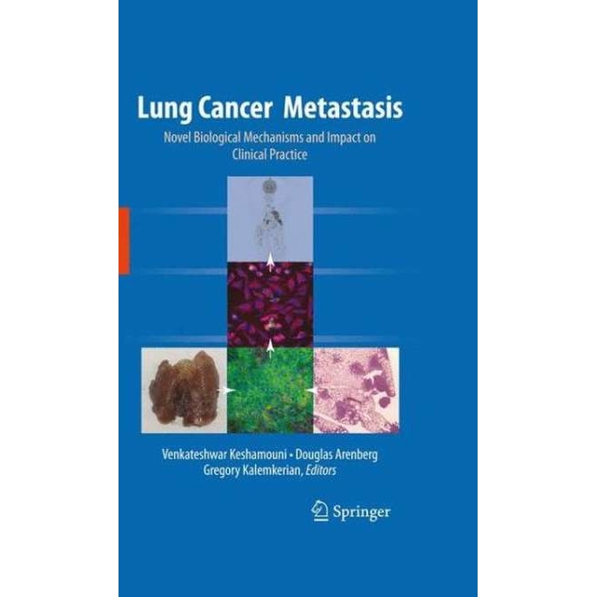 Lung Cancer Metastasis de Venkateshwar Keshamouni
