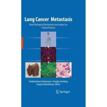 Lung Cancer Metastasis de Venkateshwar Keshamouni Lung Cancer Metastasis de Venkateshwar Keshamouni