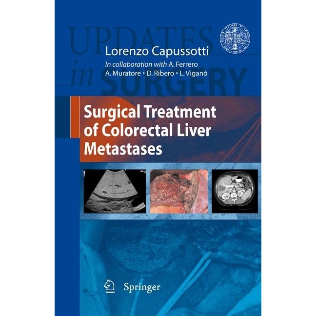Surgical Treatment of Colorectal Liver Metastases de Lorenzo Capussotti