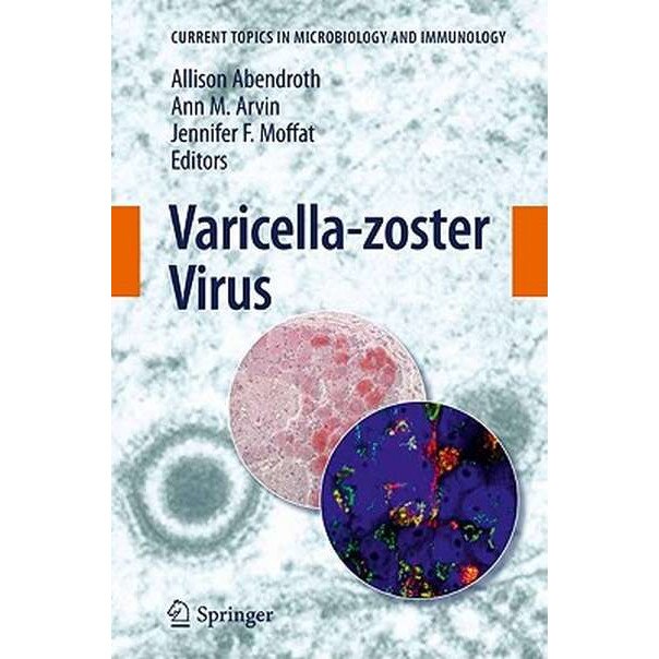 Varicella-zoster Virus de Allison Abendroth