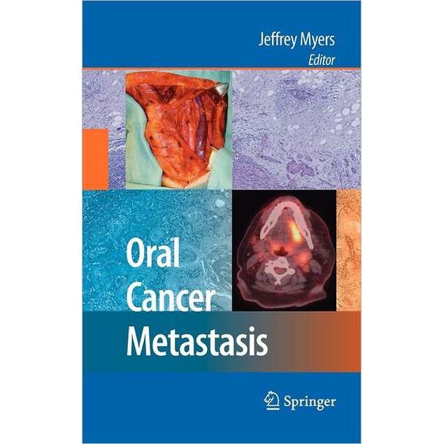 Oral Cancer Metastasis de Jeffrey Myers