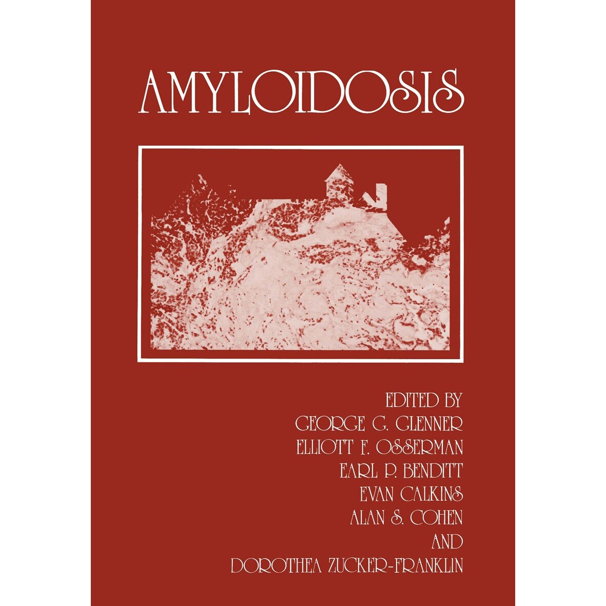 Amyloidosis de George G. Glenner