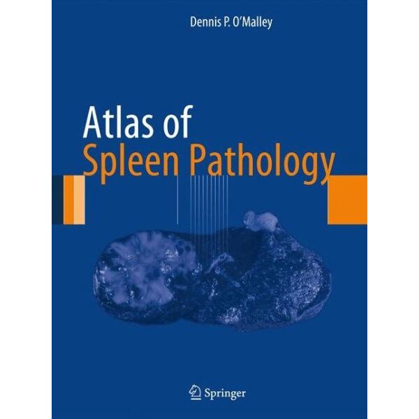 Atlas of Spleen Pathology de Dennis P. O'Malley