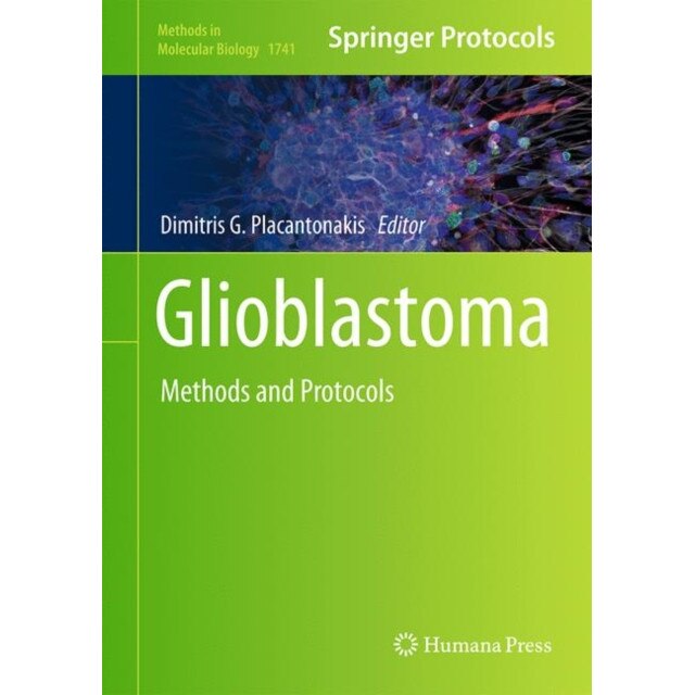 Glioblastoma de Dimitris G. Placantonakis