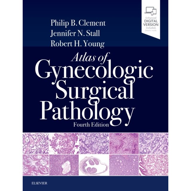 Atlas of Gynecologic Surgical Pathology de Philip B. Clement [Hardback]