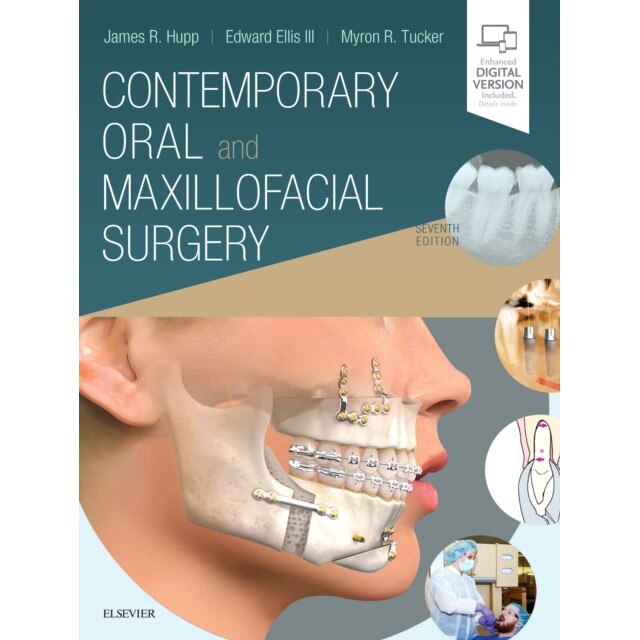 Contemporary Oral and Maxillofacial Surgery de James R. Hupp [Hardback]