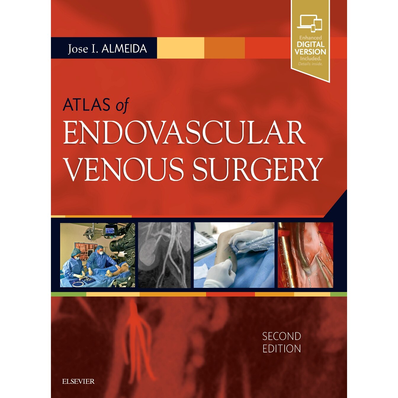 Atlas of Endovascular Venous Surgery de Jose Almeida [Hardback]