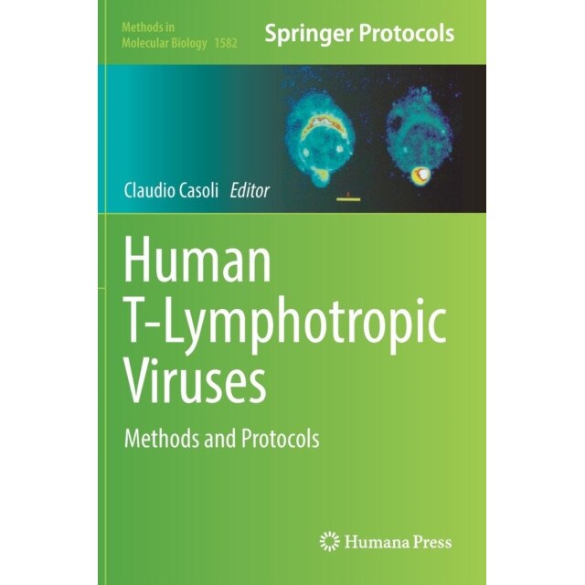 Human T-Lymphotropic Viruses de Claudio Casoli