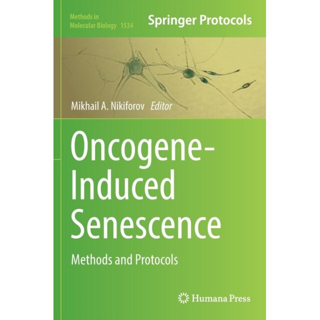 Oncogene-Induced Senescence de Mikhail A. Nikiforov