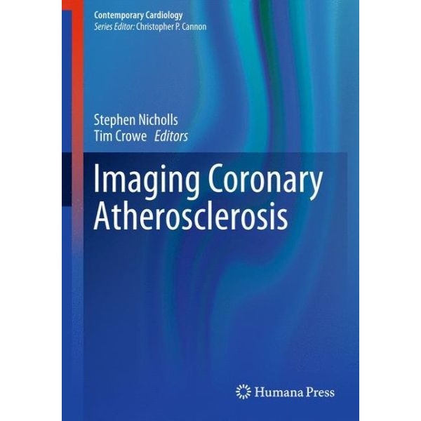 Imaging Coronary Atherosclerosis de Stephen J. Nicholls