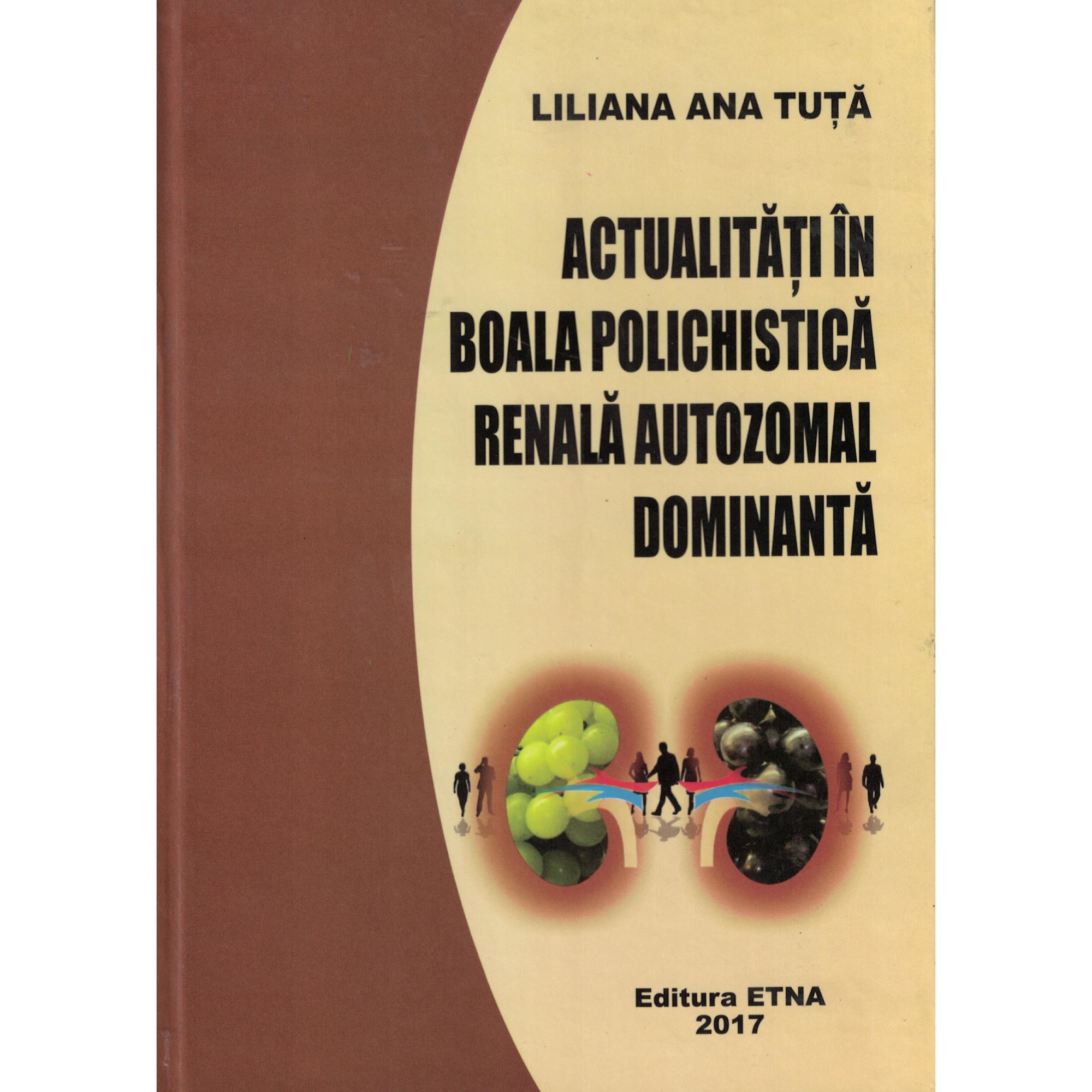 Actualitati in boala polichistica renala autozomal dominanta - Lliana Ana Tuta