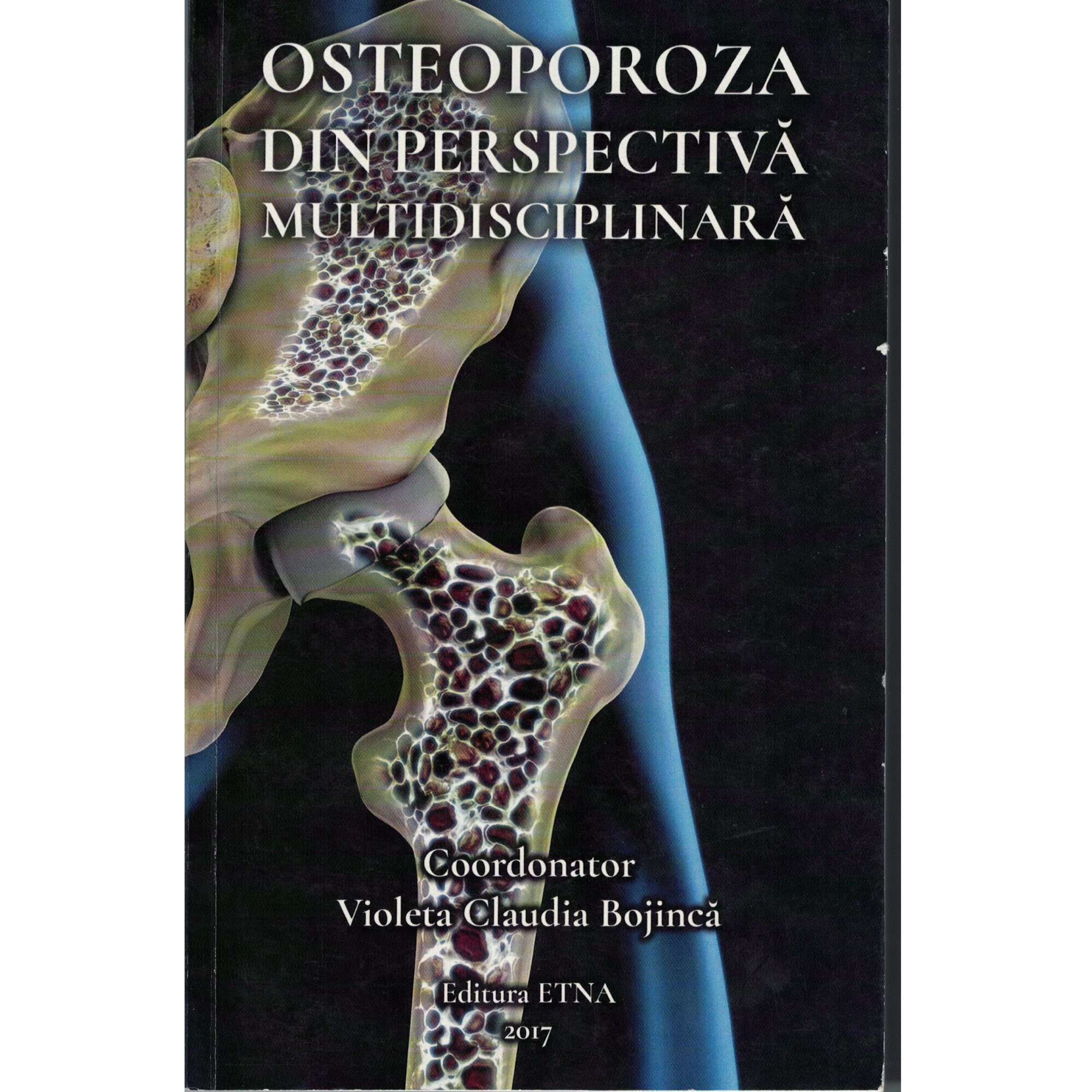 Osteoporoza din perspectiva multidisciplinara - Violeta Claudia Bojinca