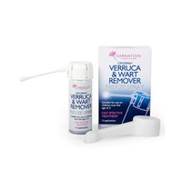 spray rece pentru indepartarea negilor 50ml - carnation imagen 10_0_
0