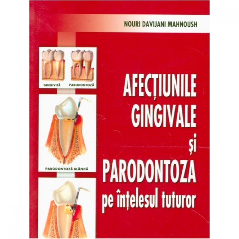 Afectiunile Gingivale