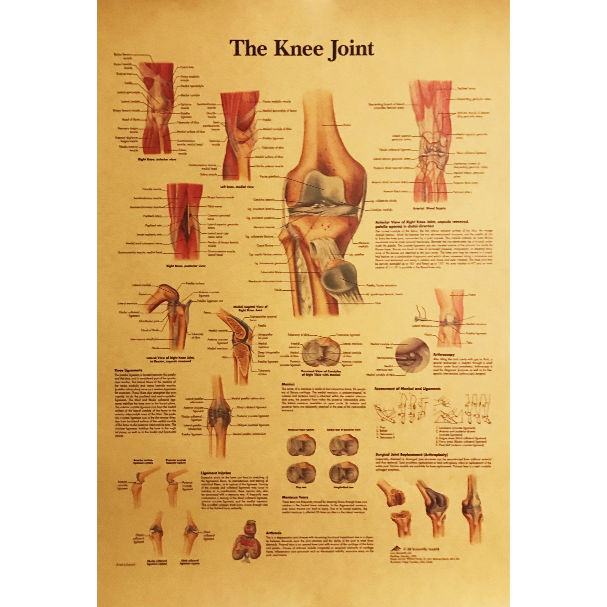 cum pot ameliora durerea cu artroza genunchiului