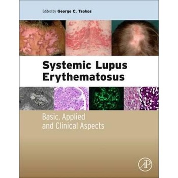 Systemic Lupus Erythematosus Systemic Lupus Erythematosus