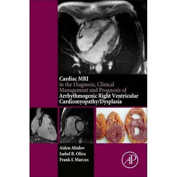 Cardiac MRI in Diagnosis, Clinical Management, and Prognosis