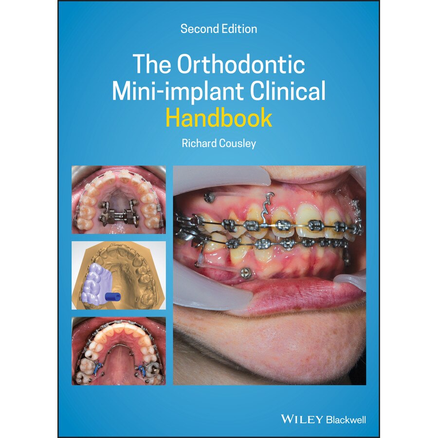 The Orthodontic Mini/-/implant Clinical Handbook de Richard Cousley