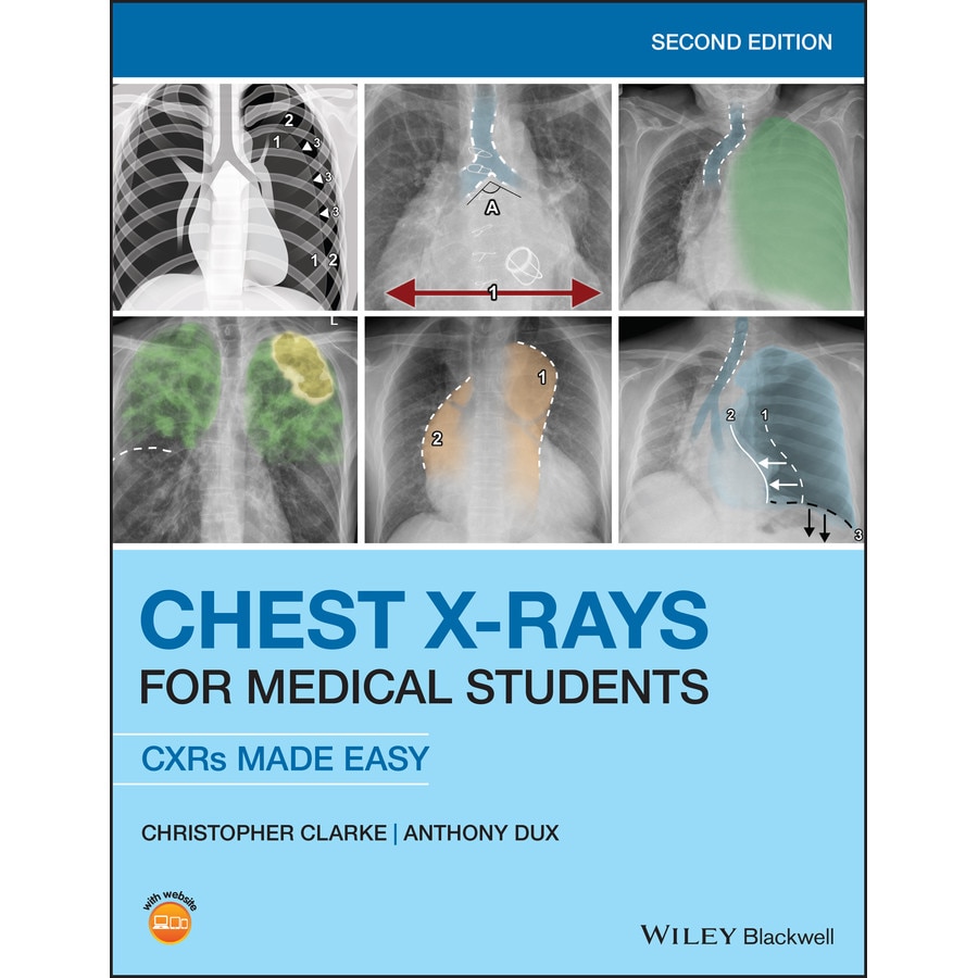 Chest X/-/Rays for Medical Students de Christopher Clarke