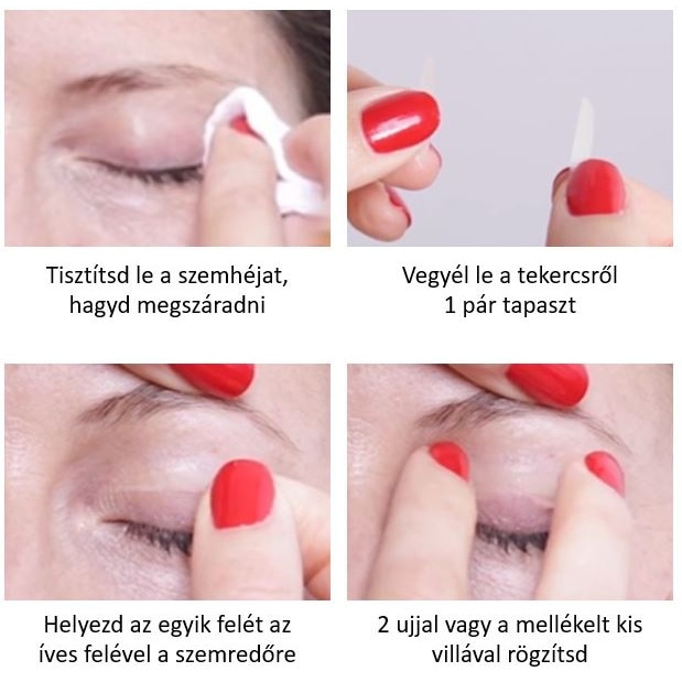 Hogyan lehet eltávolítani a szemhéj zsírlerakódását