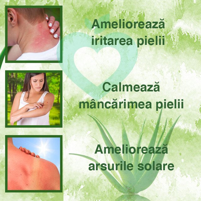 standort aloe vera drinnen Aloe vera Duo main image 1