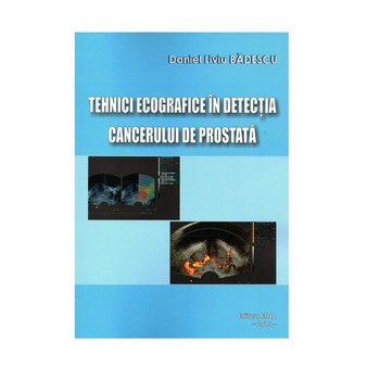 Tehnici ecografice in detectia cancerului de prostata, Daniel Liviu Badescu, Brosata, 166 pagini Tehnici ecografice in detectia cancerului de prostata, Daniel Liviu Badescu, Brosata, 166 pagini
