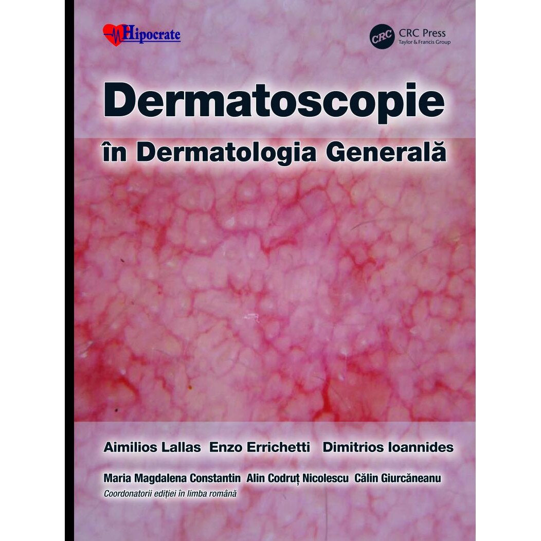 Dermatoscopie in Dermatologia Generala, Aimilios Lallas