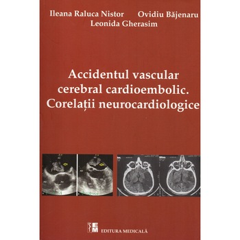 Accidentul cerebral cardioembolic Corelatii neurocardiologice Ileana Raluca Nistor Ovidiu Bajenaru Leonida Gherasim Medicala Brosata 402 pagini Accidentul cerebral cardioembolic Corelatii neurocardiologice Ileana Raluca Nistor Ovidiu Bajenaru Leonida Gherasim Medicala Brosata 402 pagini