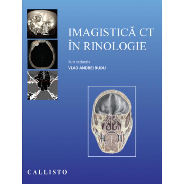 Imagistica CT in rinologie - Vlad Andrei Budu