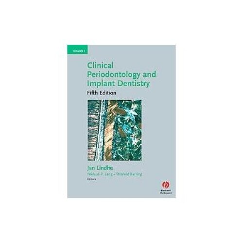 Clinical Periodontology and Implant Dentistry, Lindhe, Wiley