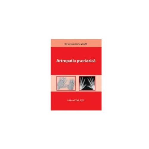 Artropatia psoriazica, Dr. Simona Liana SOARE