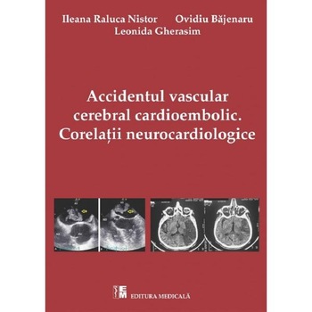 Accidentul vascular cerebral cardioembolic. Corelatii Neurocardiologice - Ileana Raluca Nistor Accidentul vascular cerebral cardioembolic. Corelatii Neurocardiologice - Ileana Raluca Nistor