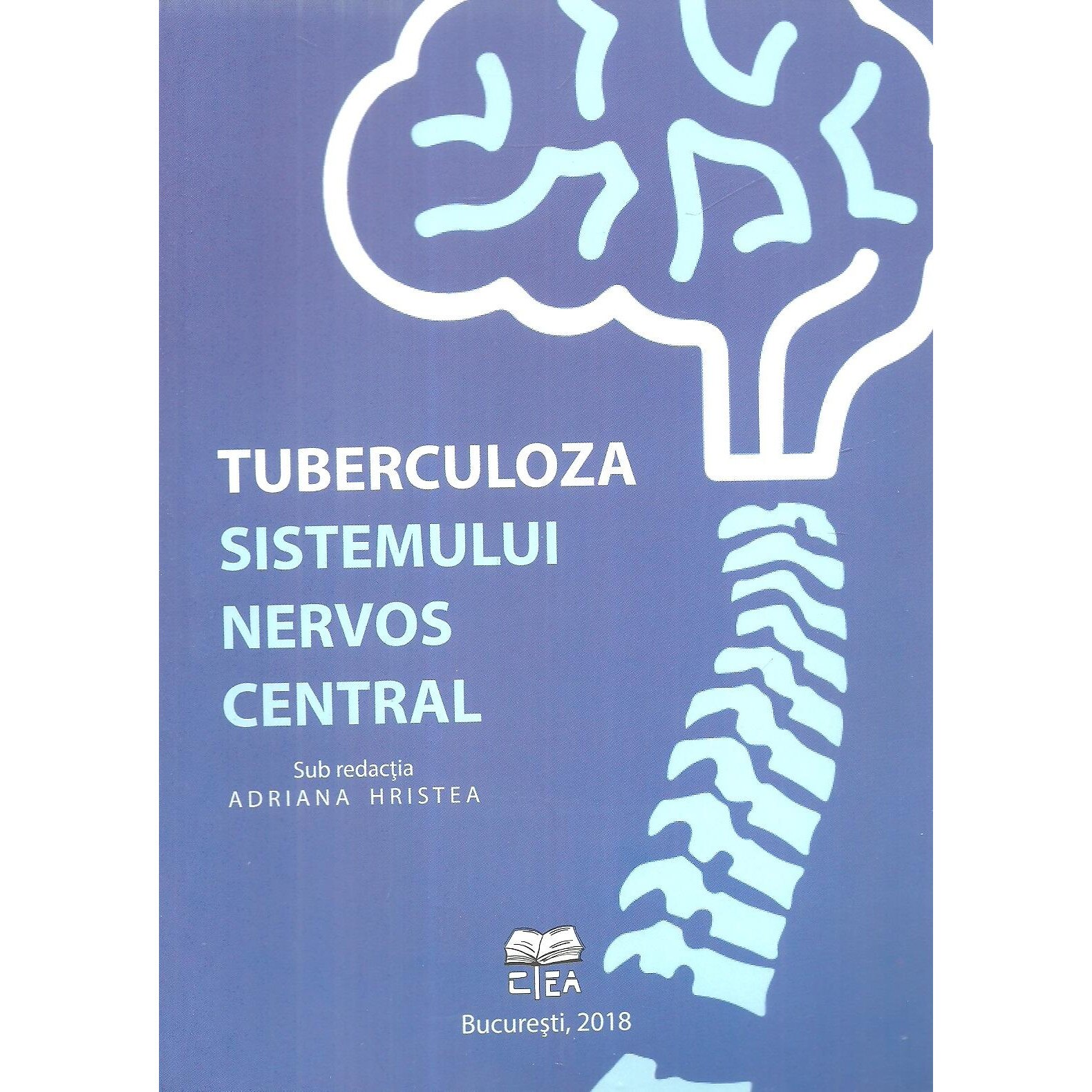 Tuberculoza sistemului nervos central, Adriana Hristea