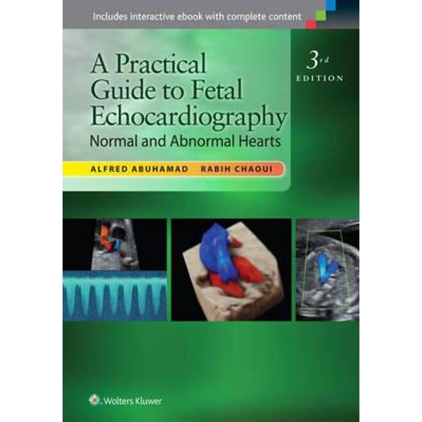 Practical Guide to Fetal Echocardiography
