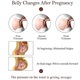 Centura Abdominala Gravide BabyToy™ G1, Orteza Corset Cu Banda Sustinere Abdomen Pentru Sarcina, Din 3 Piese Pentru Perioada Prenatala, M ,Crem