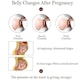 Centura Abdominala Gravide BabyToy™ G1, Orteza Corset Cu Banda Sustinere Abdomen Pentru Sarcina, Din 3 Piese Pentru Perioada Prenatala, L, Crem