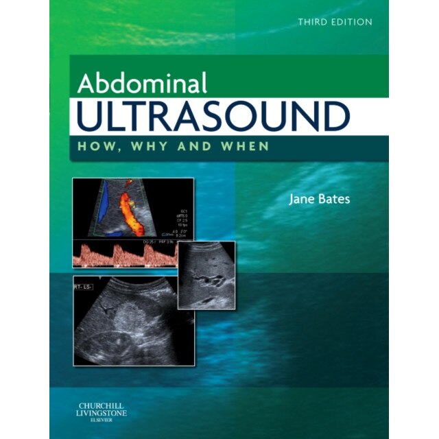 Abdominal Ultrasound de Jane A. Smith (formerly Bates)