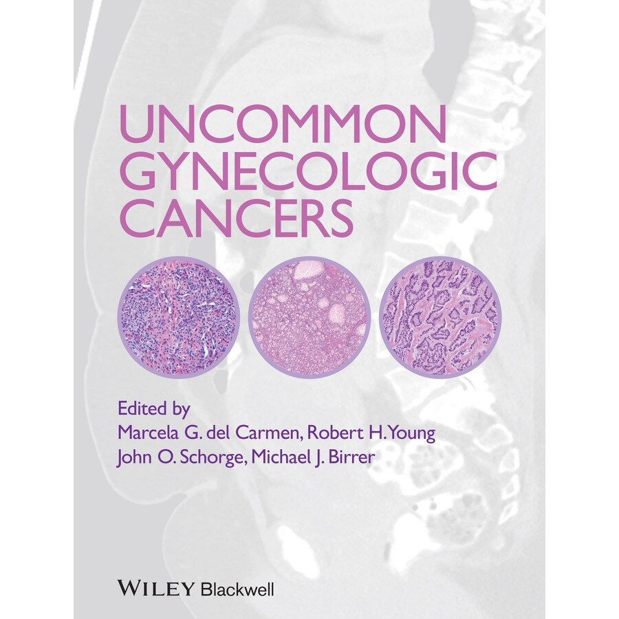 Uncommon Gynecologic Cancers de Marcela del Carmen