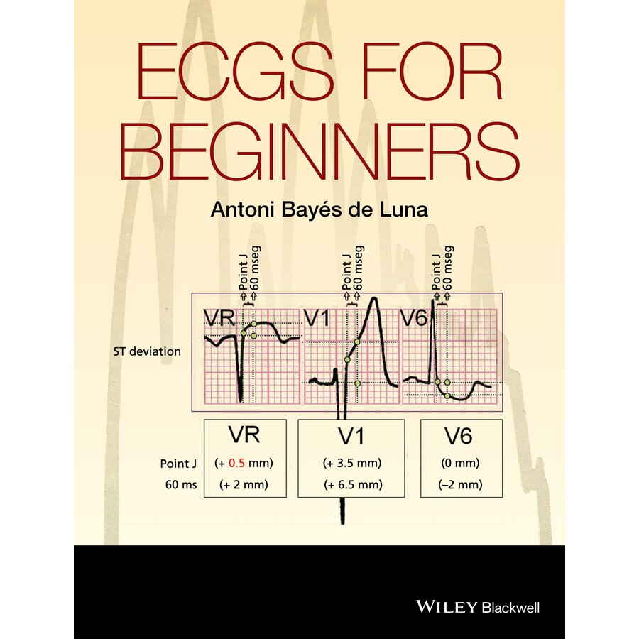 Ecgs for Beginners de Antoni Bayés de Luna