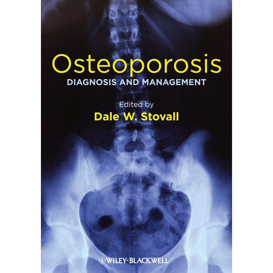 Osteoporosis de Dale W. Stovall