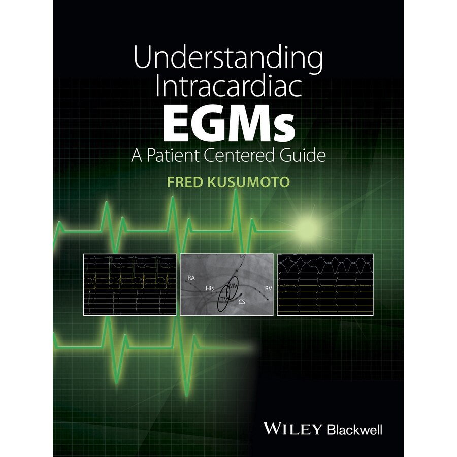 Understanding Intracardiac EGMs de Fred M. Kusumoto
