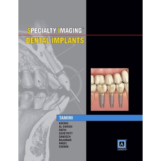 Specialty Imaging: Dental Implants de Dania Tamimi