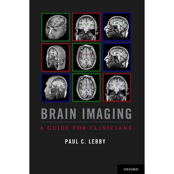 Brain Imaging de Paul C. Lebby